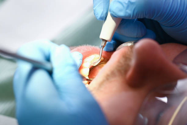 Best Pediatric Emergency Dentist in Hercules, CA