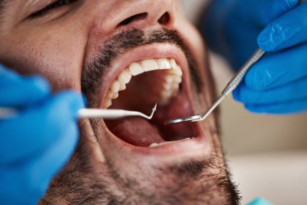 Best Emergency Cosmetic Dentistry in Hercules, CA