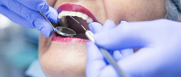 Best Emergency Dentist for Lost Fillings or Crowns in Hercules, CA